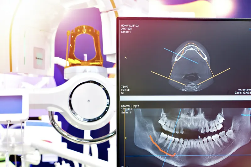 Digital X-Rays at Little Teeth Pediatric Dentistry & Orthodontics